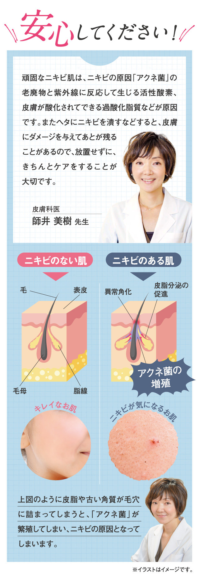 安心して下さい！頑固なニキビ肌はキチンとケアすることが大切。